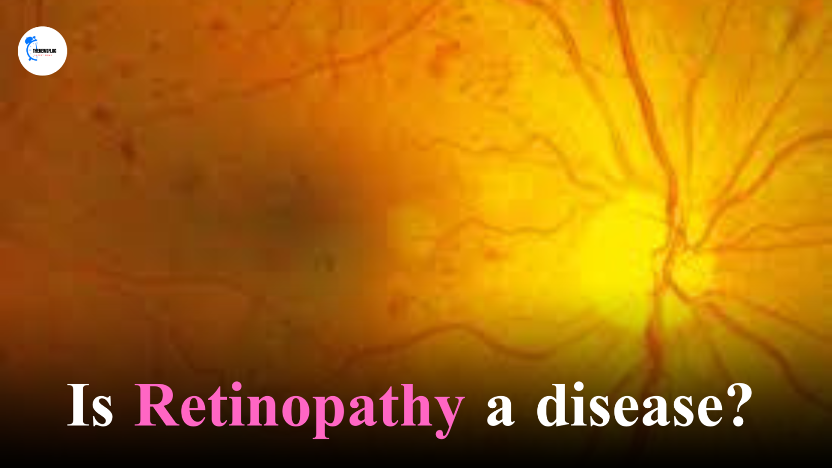 Is Retinopathy a disease?