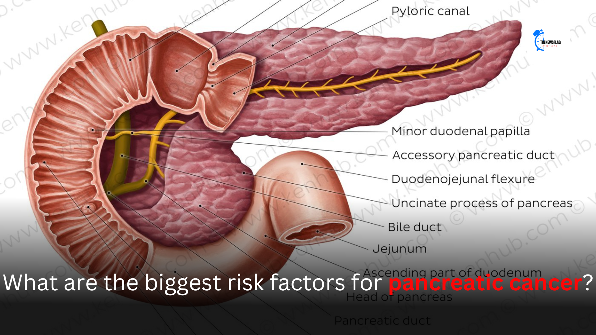 What are the biggest risk factors for pancreatic cancer?